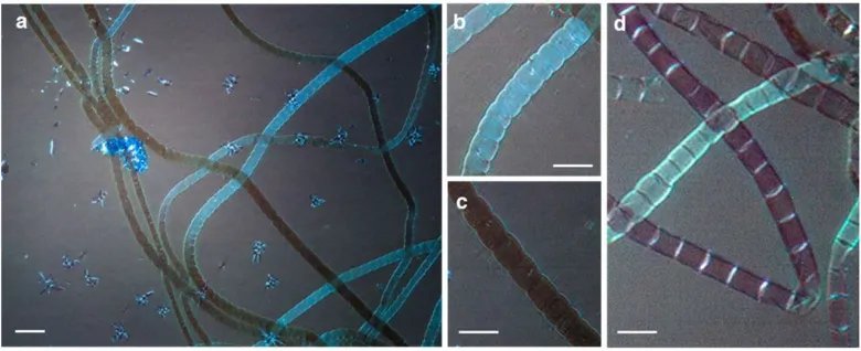 The materials for which the Nobel Prize was awarded were found in living nature for the first time bacteria wires metal